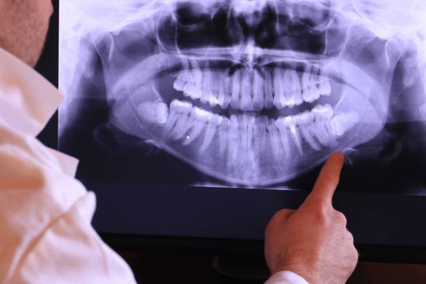 Best Emergency Tooth Extraction in Devola, OH