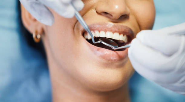 Best Emergency Gum Treatment in Devola, OH