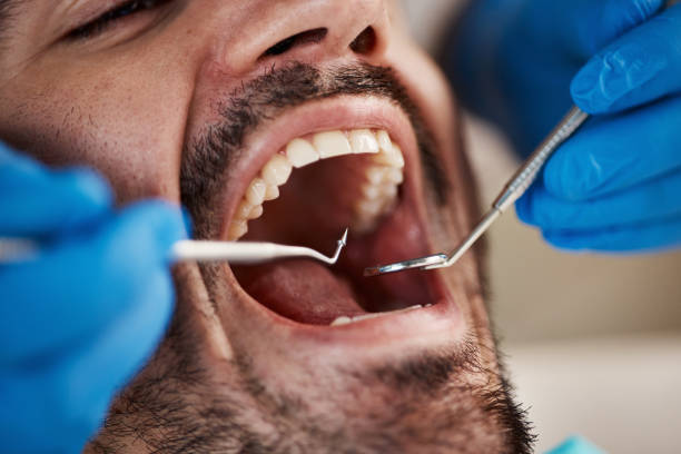 Best Urgent Care for Lost Fillings or Crowns in Devola, OH
